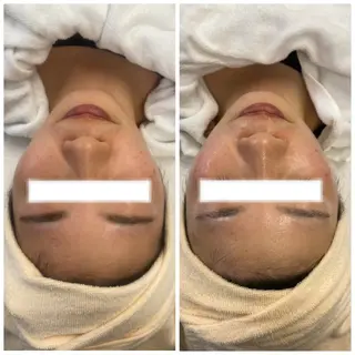 アイブロウ 肌質改善美容サロン ému 用賀のエステ・リラクイメージ