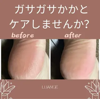 メンズ キッズ 肌質改善・脱毛サロン Luangeのエステ・リラクイメージ