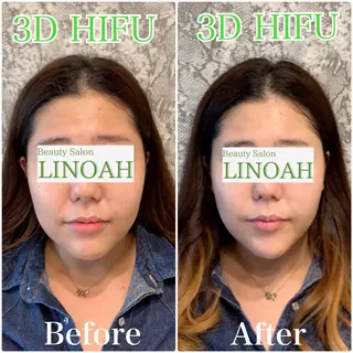 メンズ アイブロウ マツエク・マツパ ビューティーサロン リノアのエステ・リラクイメージ