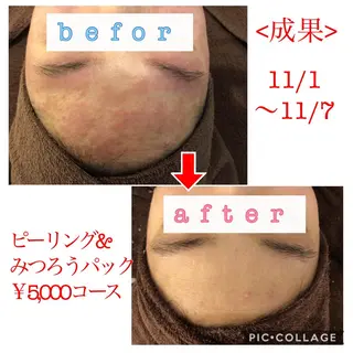 ロング カラー パーマ ヘアアレンジ メンズ キッズ ネイル マツエク・マツパ 四つ星サロン🎖 腸＆ニキビケアに特化のエステ・リラクイメージ