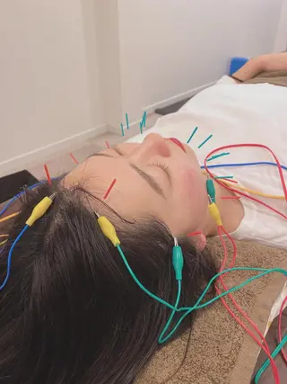 美容鍼灸Solana所属・肌質改善×美容鍼 ゆいのエステ・リラクイメージ