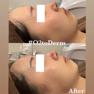 crescent所属・【韓国肌管理・脱毛】 クレセントのエステ・リラクイメージ