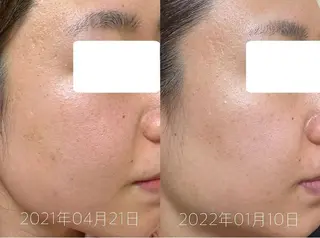 肌質改善美容サロン ému 用賀のエステ・リラクイメージ