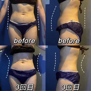 🧚‍♀️優来 リラク痩身肌質改善のエステ・リラクイメージ