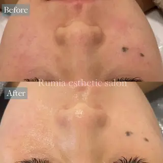 Rumia Salonのエステ・リラクイメージ