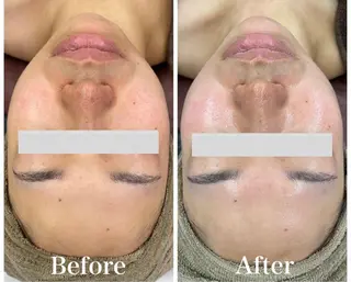 Beauty Salon Ciel　Chiba所属・BeautySalo nCielChibaのエステ・リラクイメージ