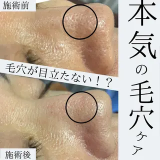 ハーブピーリング・毛穴ケア専門サロンSalon de LENA所属・ハーブピーリング 専門店/名古屋駅前店のエステ・リラクイメージ