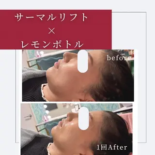 小顔矯正専門店 ❤️池田 桃花のエステ・リラクイメージ