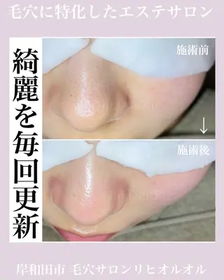 毛穴汚れ改善専門店/ 岸和田/リヒオルオルのエステ・リラクイメージ