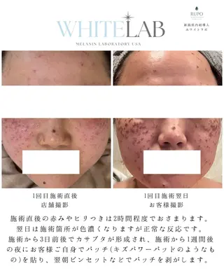 RUPO THE MAINTENANCE新潟店【ローマピンク公式認定店/ララピール正規店/骨格小顔】所属・オーナー Nanjoのエステ・リラクイメージ