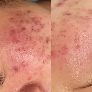 VERY VERY九条店所属・ベリーベリー🌹 九条店のエステ・リラクイメージ