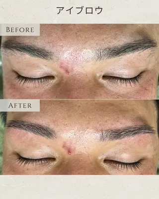 メンズ シミ毛穴ケア EsteAのエステ・リラクイメージ