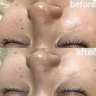 アイブロウ&フェイシャルサロンa‘lm所属・WAX脱毛/肌質改善 眉毛とお肌のサロンのエステ・リラクイメージ