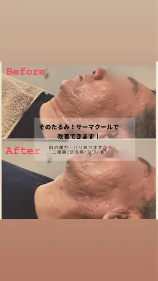 セミロング カラー パーマ ヘアアレンジ メンズ キッズ ネイル マツエク・マツパ アイブロウ 毛穴，ニキビ跡 改善総合サロンのその他イメージ