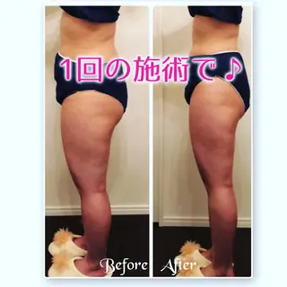 FLEUR大阪・美容 整体・痩身・小顔のエステ・リラクイメージ