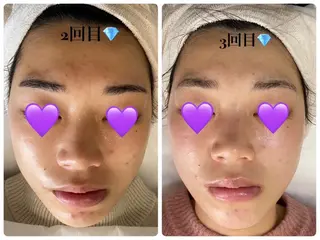 De I'm トータルビューティーサロン所属・COCO beautyサロンのエステ・リラクイメージ