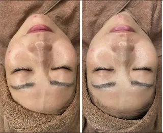 美肌/小顔/眉毛の 専門店 ルミナスの眉毛・アイブロウイメージ