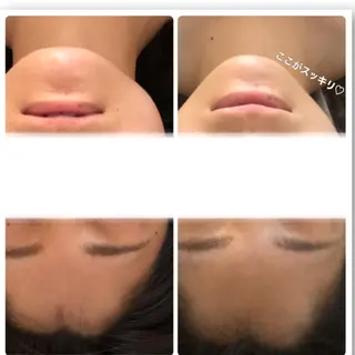 FLEUR大阪・美容 整体・痩身・小顔のエステ・リラクイメージ