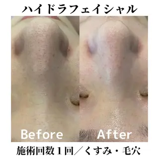 トータルビューティー サロンSalaのマツエク・マツパデザイン