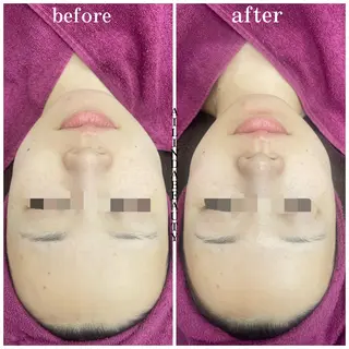 AILINDA BEAUTYのその他イメージ