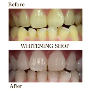 メンズ ホワイトニング ショップ川越店のエステ・リラクイメージ