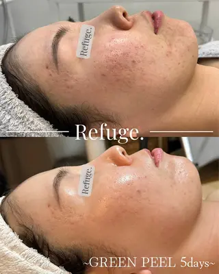 グリーンピール専門サロン Refuge.所属・Refuge. （リフュージュ）のエステ・リラクイメージ