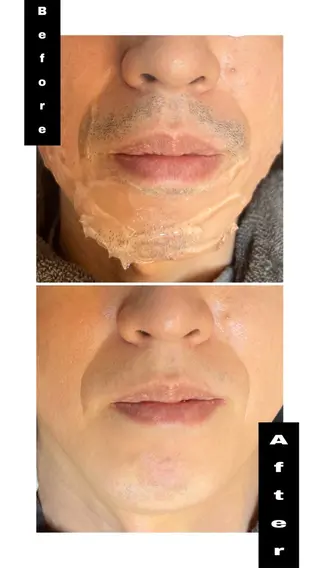 メンズ 毛穴洗浄特化🫧 オオツカのエステ・リラクイメージ