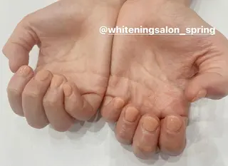 ネイル Nakao Hitomiのネイルデザイン