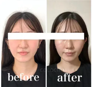 小顔と ヘッドスパのお店のエステ・リラクイメージ