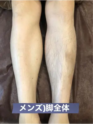 メンズ ブラジリアン☆WAX 🎖🌚YUKI🌚のエステ・リラクイメージ