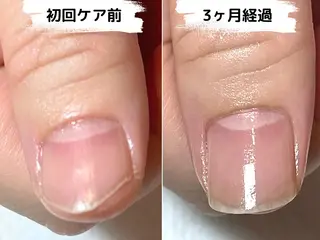 ネイル Ka pilina所属・自爪育成専門店 Kapilinaのネイルデザイン