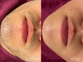 saronM所属・saron Mのエステ・リラクイメージ