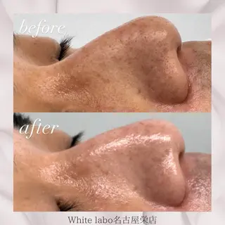 White labo 🌿KAORIの眉毛・アイブロウイメージ