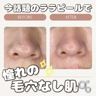 中目黒ハーブピーリン グ🌿ララピールのエステ・リラクイメージ