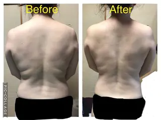 子宮矯正/腸揉み/ シュガーリング脱毛のエステ・リラクイメージ