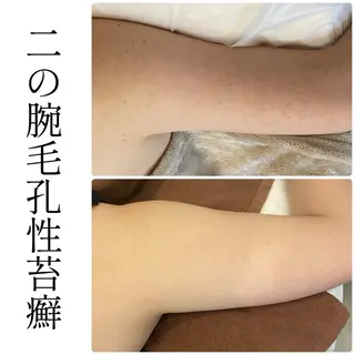 ハーブピーリング専門 BIOEL横浜のエステ・リラクイメージ