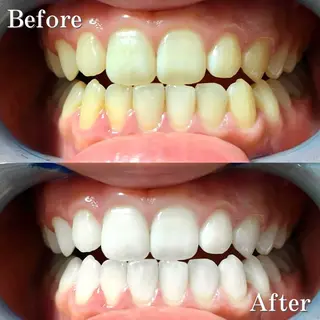 セミロング パーマ カラー メンズ ヘアアレンジ ネイル マツエク・マツパ アイブロウ LBSホワイトニング 銀座店💎店長浦和のその他イメージ