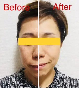 ニキビ・ 肌荒れ専門店のエステ・リラクイメージ