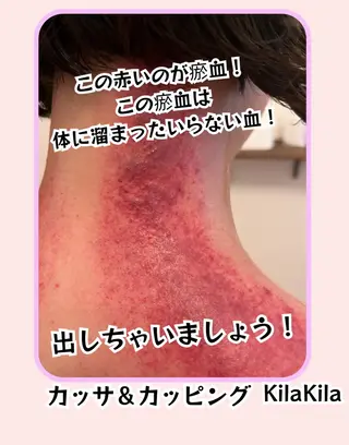 ドライヘッドスパ KilaKilaのエステ・リラクイメージ