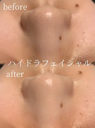 lifra CHISAのエステ・リラクイメージ
