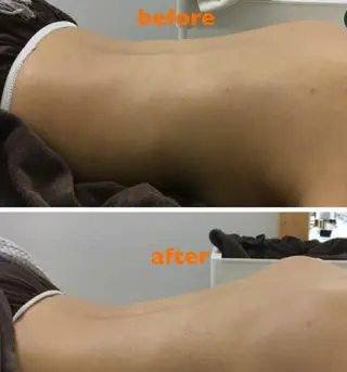 beauty salon by BMbm所属・名倉 彩乃のエステ・リラクイメージ