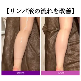 ☆痩身/小顔☆ 結果出します☆のエステ・リラクイメージ