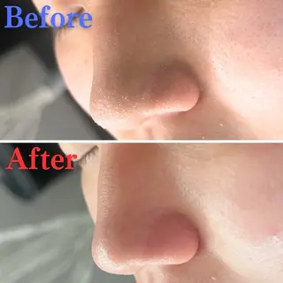 毛穴洗浄特化🫧 オオツカのエステ・リラクイメージ