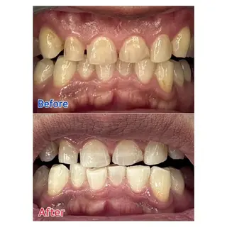 MBEAUTYSALON 千葉店・京成大久保所属・Melty 輝のその他イメージ