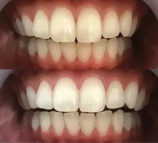 セミロング カラー パーマ ヘアアレンジ ネイル マツエク・マツパ アイブロウ LBSホワイトニング 🌐梅田店公式のエステ・リラクイメージ