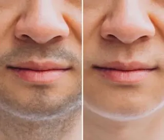 メンズ 【光＆WAX脱毛】セラヴィプライベートサロン（メンズ・キッズも可）所属・kaise makiのエステ・リラクイメージ