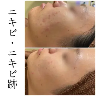 ハーブピーリング専門 BIOEL横浜のエステ・リラクイメージ