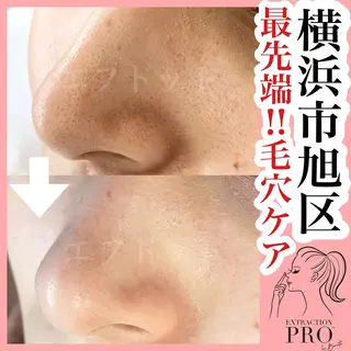 f.【エフドット】 二俣川のマツエク・マツパデザイン