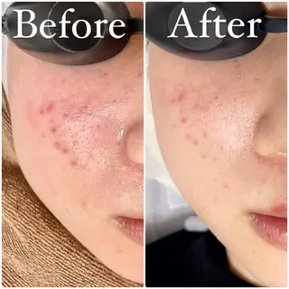 都度払い脱毛 BARNEYのエステ・リラクイメージ