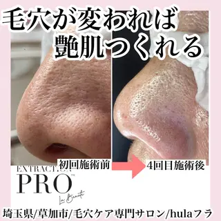 アイブロウ 毛穴専門店hula 杉山智美のエステ・リラクイメージ